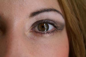 What is an eye stye?