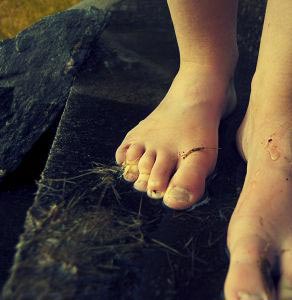home remedies for dry feet